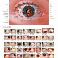 Chinese Medicine Eye Chart