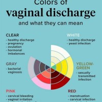 Discharge Color Chart