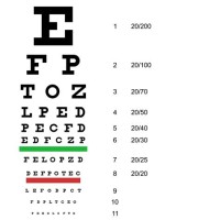Eye Exam Using Snellen Chart