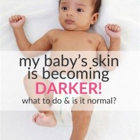 Newborn Baby Skin Color Chart