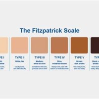 Skin Tone Chart Fitzpatrick