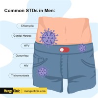 Std Symptoms Chart Male
