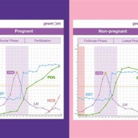 T Chart For Early Pregnancy