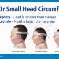 Baby Head Size Chart