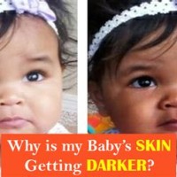 Baby Skin Color Chart
