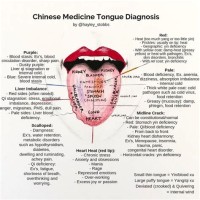 Chinese Acupuncture Tongue Chart