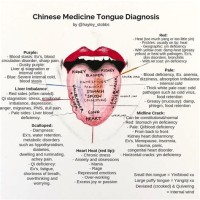 Chinese Tongue Diagnosis Acupuncture Chart