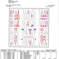 Dental Code For Periodontal Charting