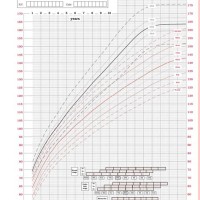 Growth Chart For Turner Syndrome