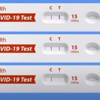 How To Read Mychart Cvs Covid Test Results