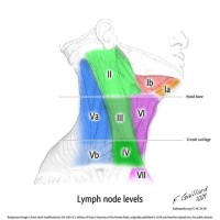 Lymph Node Size Chart Neck