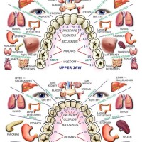 Referred Dental Chart