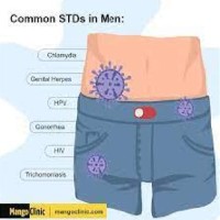 Std Symptoms Chart Male